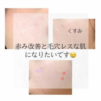 ソフティモ スーパークレンジングウォッシュ(ヒアルロン酸)/ソフティモ/洗顔フォームを使ったクチコミ(1枚目)