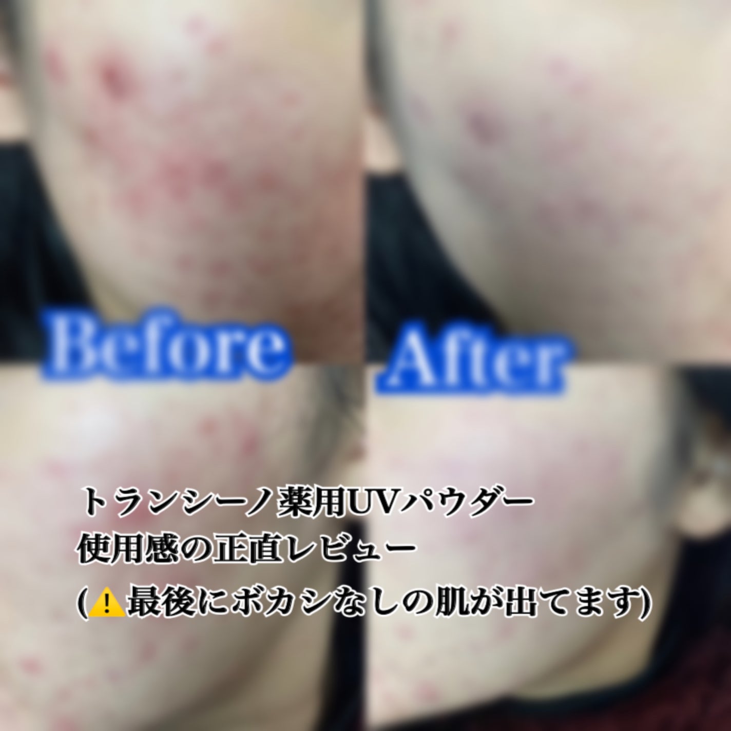 ãã©ã³ã·ãŒãè¬çšïŒµïŒ¶ããŠããŒïŒ¥ïŒž/ãã©ã³ã·ãŒã/æ¥çŒãæ¢ãããŠããŒã䜿ã£ãã¯ãã³ãïŒ1æç®ïŒ