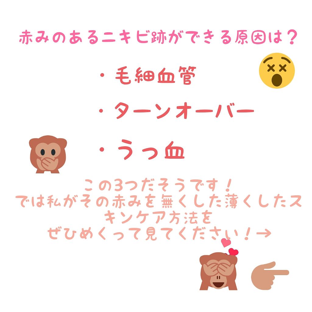 薬用洗顔フォーム/スキンライフ/洗顔フォームを使ったクチコミ（2枚目）