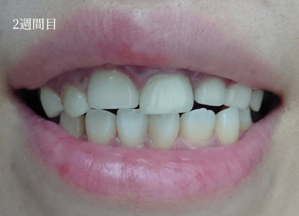 ðð®ðððð¢â¡ on LIPS ãããã«ã¡ã¯ïŒä»¥åã¹ãã·ã£ã«ãªã»ãããé ããŸããŠCOCOWHIT..ãïŒ3æç®ïŒ