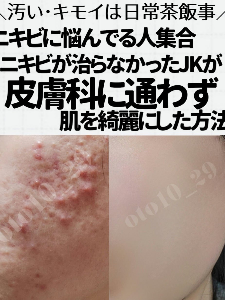 DHC 持続型ビタミンC/DHC/美容サプリメントを使ったクチコミ（1枚目）