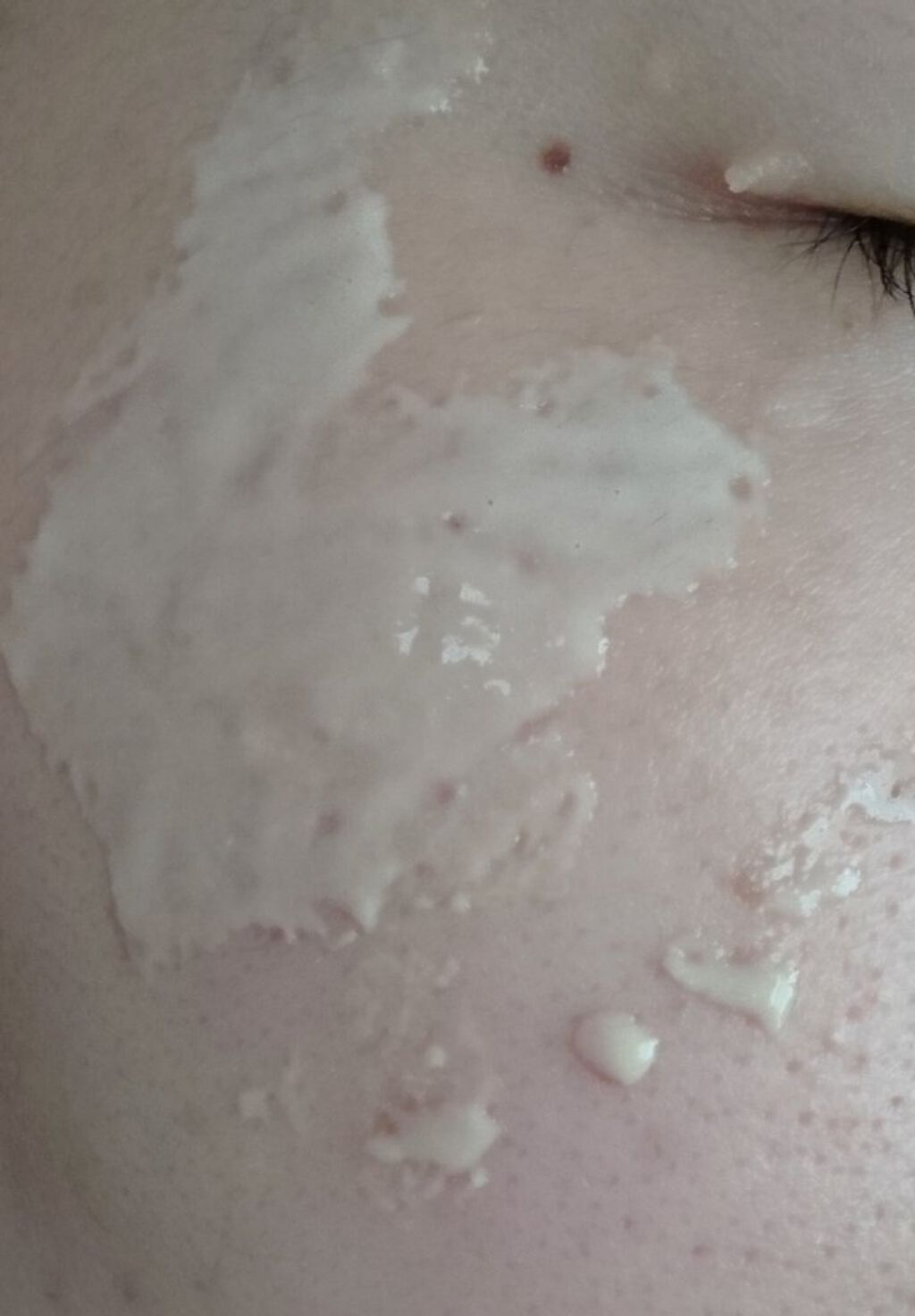 レディブラン 薬用美白ピールホワイト/シーヴァ/洗い流すパック・マスクを使ったクチコミ(7枚目)