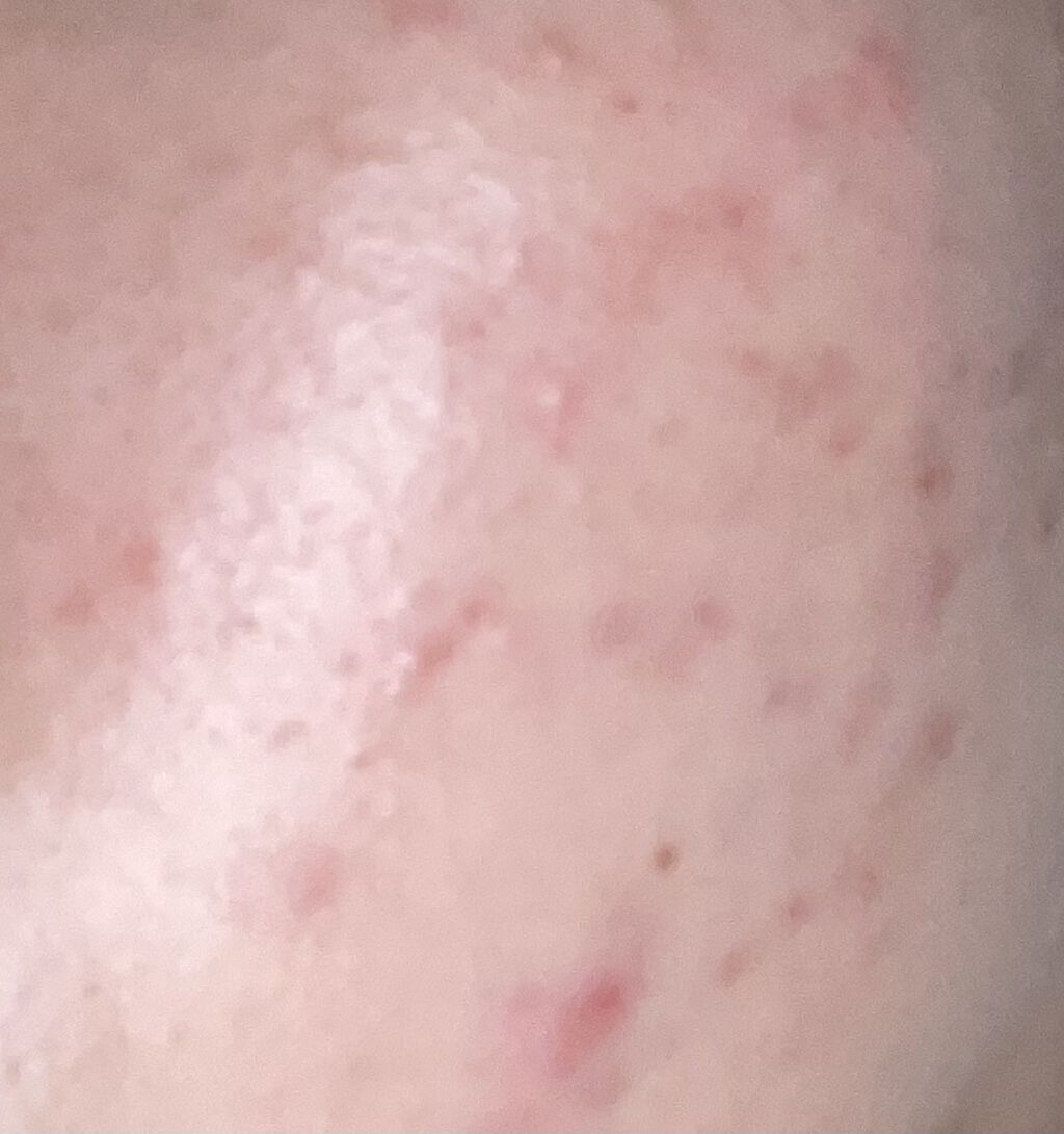 潤浸保湿 化粧水 III とてもしっとり/キュレル/化粧水を使ったクチコミ（1枚目）