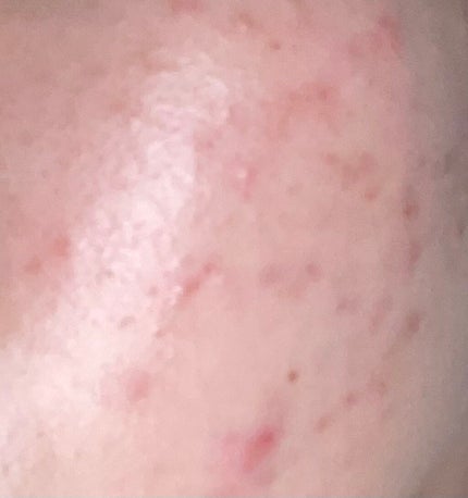 潤浸保湿 化粧水 III とてもしっとり/キュレル/化粧水を使ったクチコミ(1枚目)