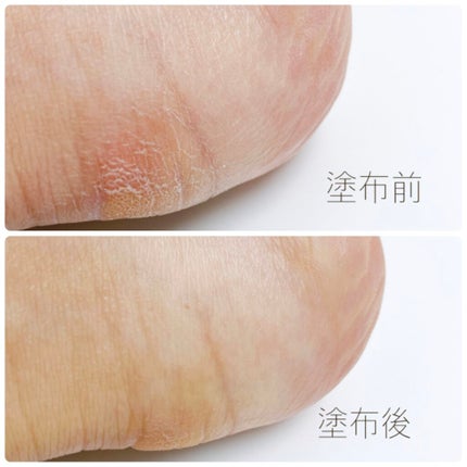 ノルウェーフォーミュラ インテンスリペア リッチバーム/Neutrogena/フェイスバームを使ったクチコミ(4枚目)