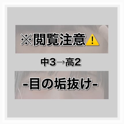 理想のふたえ くっきりクセづけ クリアワイド/セリア/二重まぶた用アイテムを使ったクチコミ(1枚目)