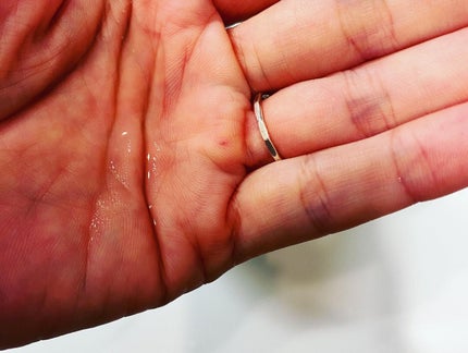 lovebeer on LIPS 「私が通う皮膚科帰りの調剤薬局に、必ず置いてあるのがNOVシリー..」(9枚目)