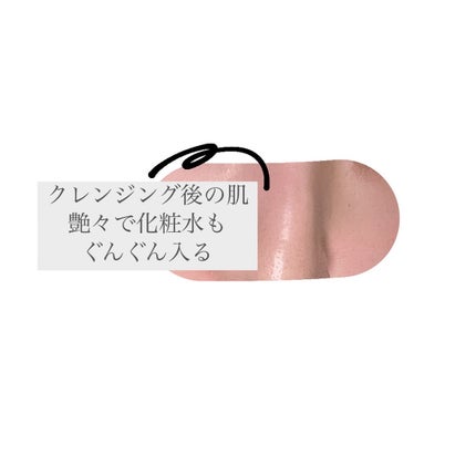 ブラックジェルクレンジング/.akaran/クレンジングジェルを使ったクチコミ(4枚目)