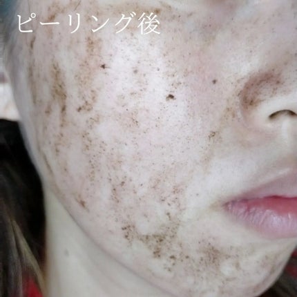ダーマスキンピーリング/BQCELL/その他キットセットを使ったクチコミ(3枚目)