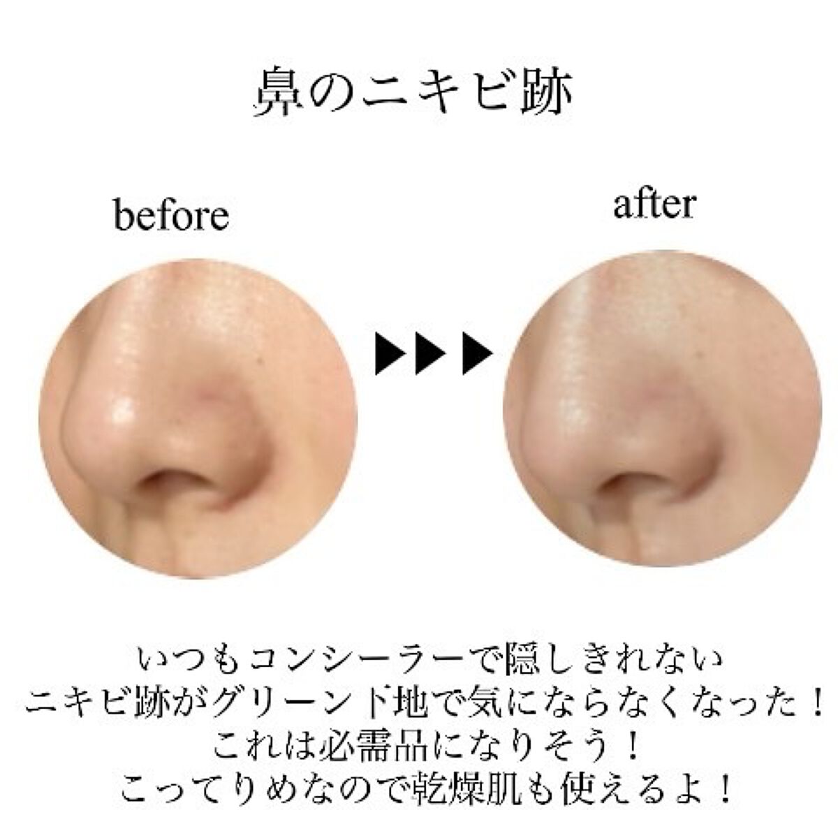 スーパーシカグリーントーンアップベース/MEDICUBE/化粧下地を使ったクチコミ（3枚目）