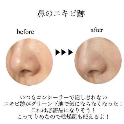 スーパーシカグリーントーンアップベース/MEDICUBE/化粧下地を使ったクチコミ(3枚目)