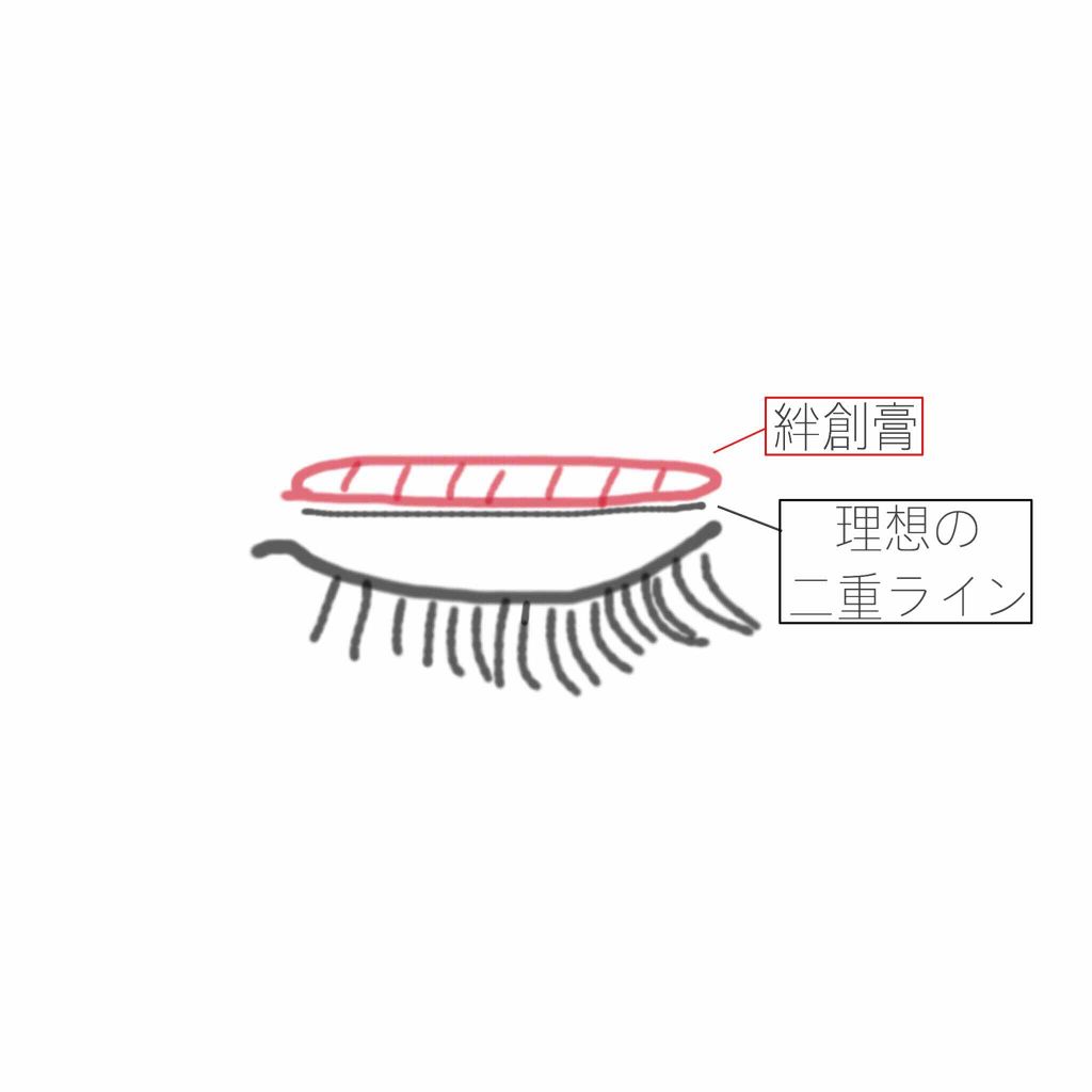 アイテープ片面(のびる)絆創膏タイプ スリム 120枚/セリア/二重まぶた用アイテムを使ったクチコミ（3枚目）