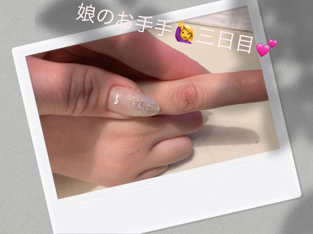 ✼••┈┈••✼••┈┈••✼••┈┈••✼••┈┈••✼
娘三日目のお手手🙋‍♀️

三日目だけど、ほぼなおりました\(//∇//)\💕

五日目検証予定が。。

明日にはなおりますよぅに💕
✼••┈┈••✼••┈┈••✼••┈┈•