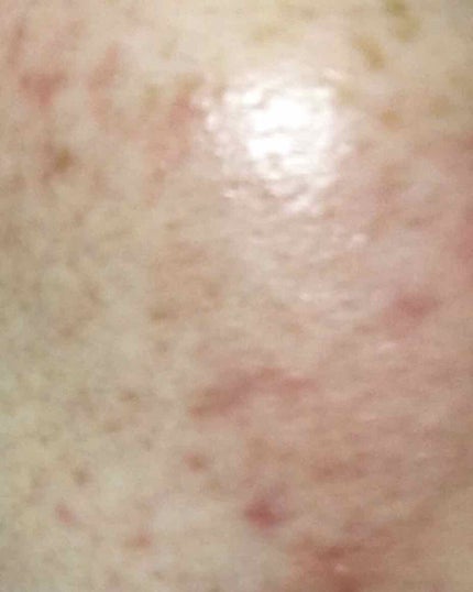 エテュセ リップエッセンス/ettusais/リップ美容液を使ったクチコミ(3枚目)