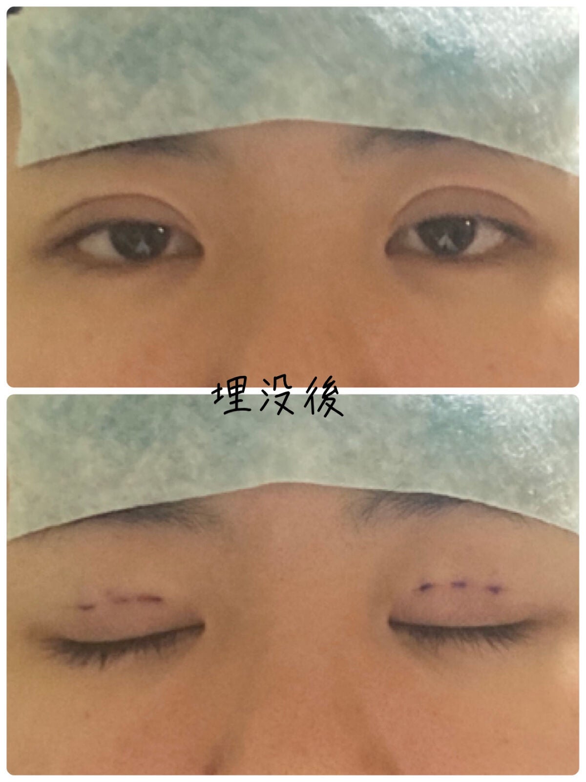 ããŸã®ãð» on LIPS ãç§ã®å没(äºéæŽåœ¢)ã«ã€ããŠðããã«ã¡ã¯ïŒãããªãã§ããç§æŽåœ¢..ãïŒ3æç®ïŒ