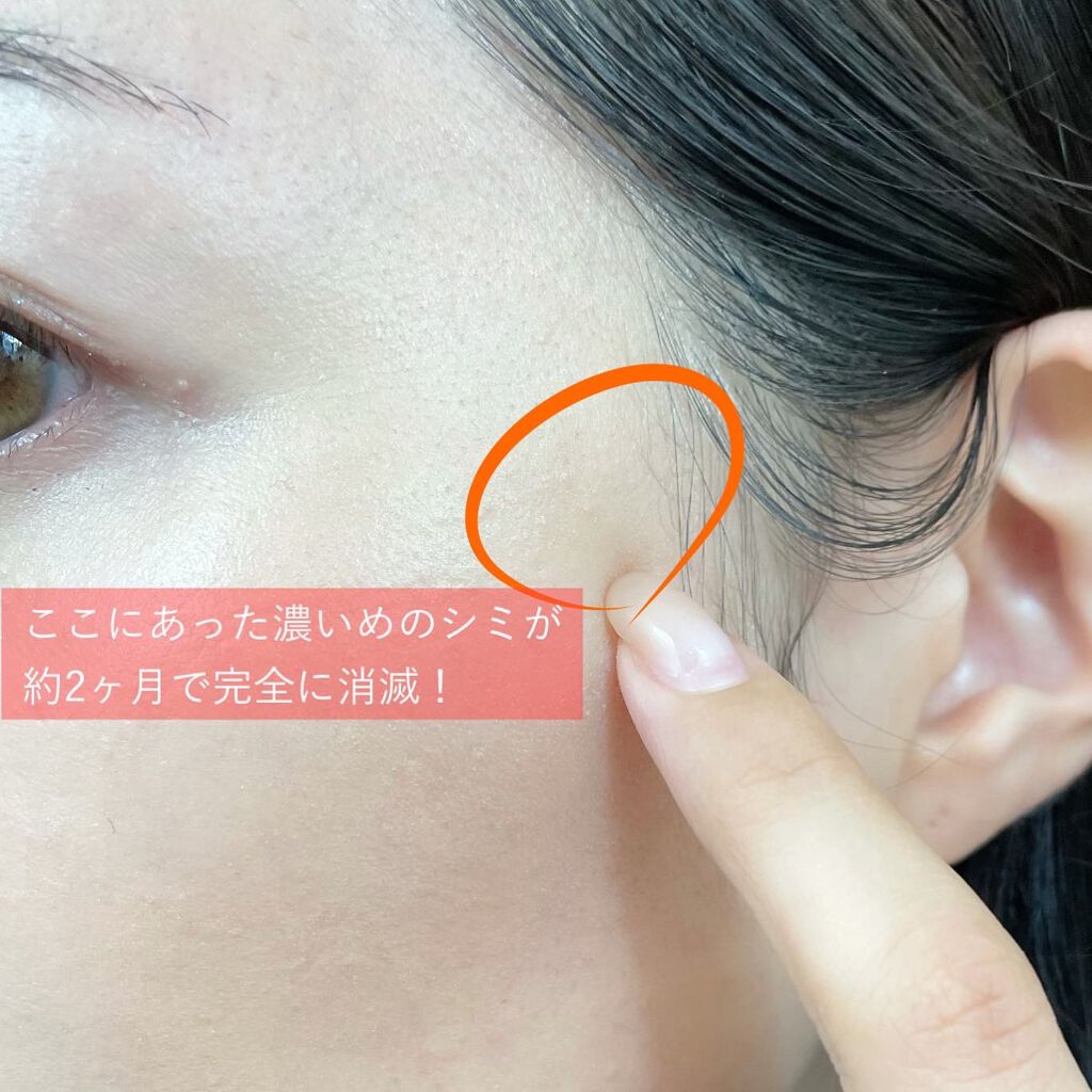 ミラミン｜ZO Skin Healthの効果に関する口コミ - 以前ご紹介した攻め
