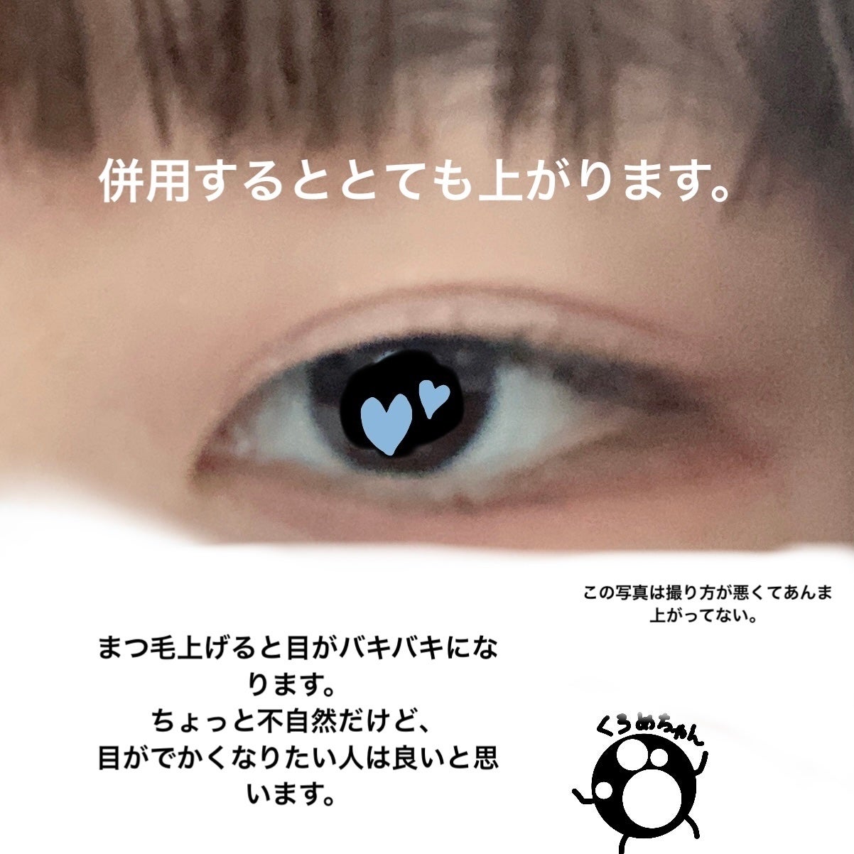 ナチュラルヌードアイテープII スリム/ドリームマジック/二重まぶた用アイテムを使ったクチコミ(9枚目)