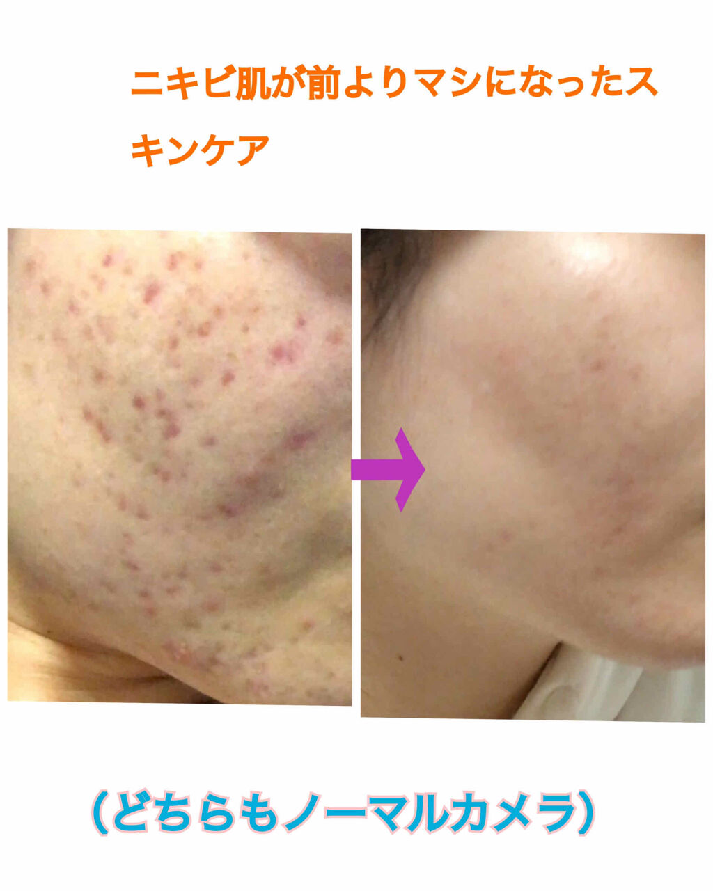 グリーンティーシード セラム/innisfree/美容液を使ったクチコミ（2枚目）