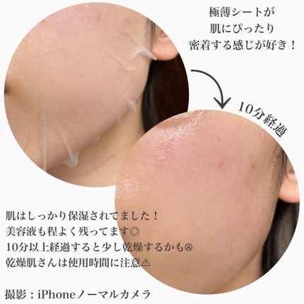 CICA デイリースージングマスク/VT/シートマスク・パックを使ったクチコミ(4枚目)