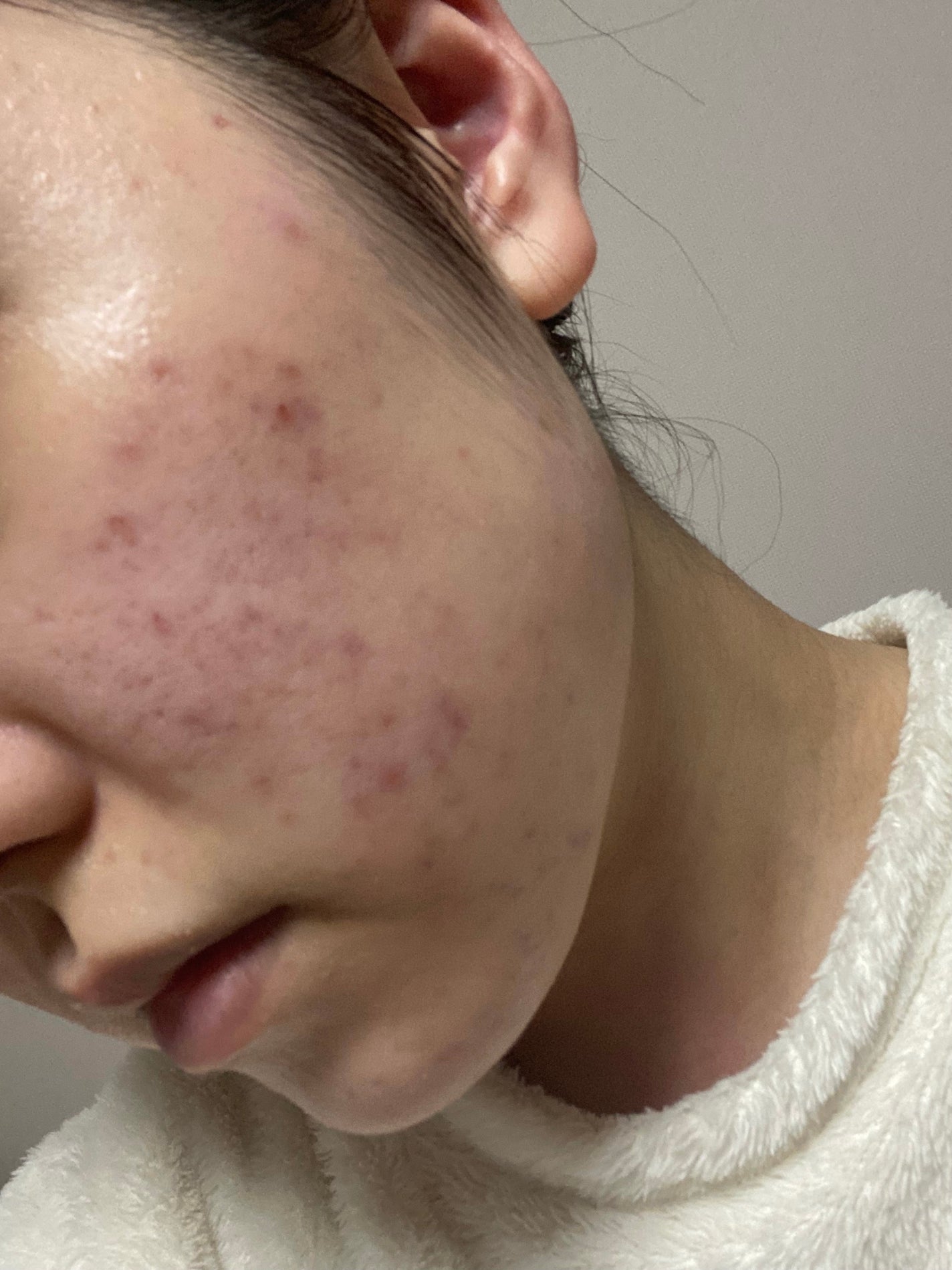 ããð± on LIPS ããã£ãšæ°ã«ãªã£ãŠããã·ã«ã¬ãã賌å
¥ããã®ã§ã2ã¶æã»ã©äœ¿çšãç¶..ãïŒ4æç®ïŒ