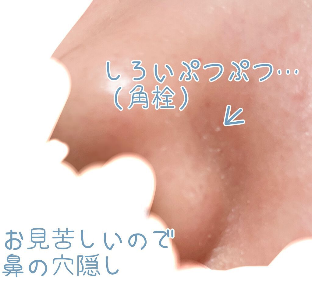 薬用 しみ 集中対策 美容液/メラノCC/美容液を使ったクチコミ(2枚目)