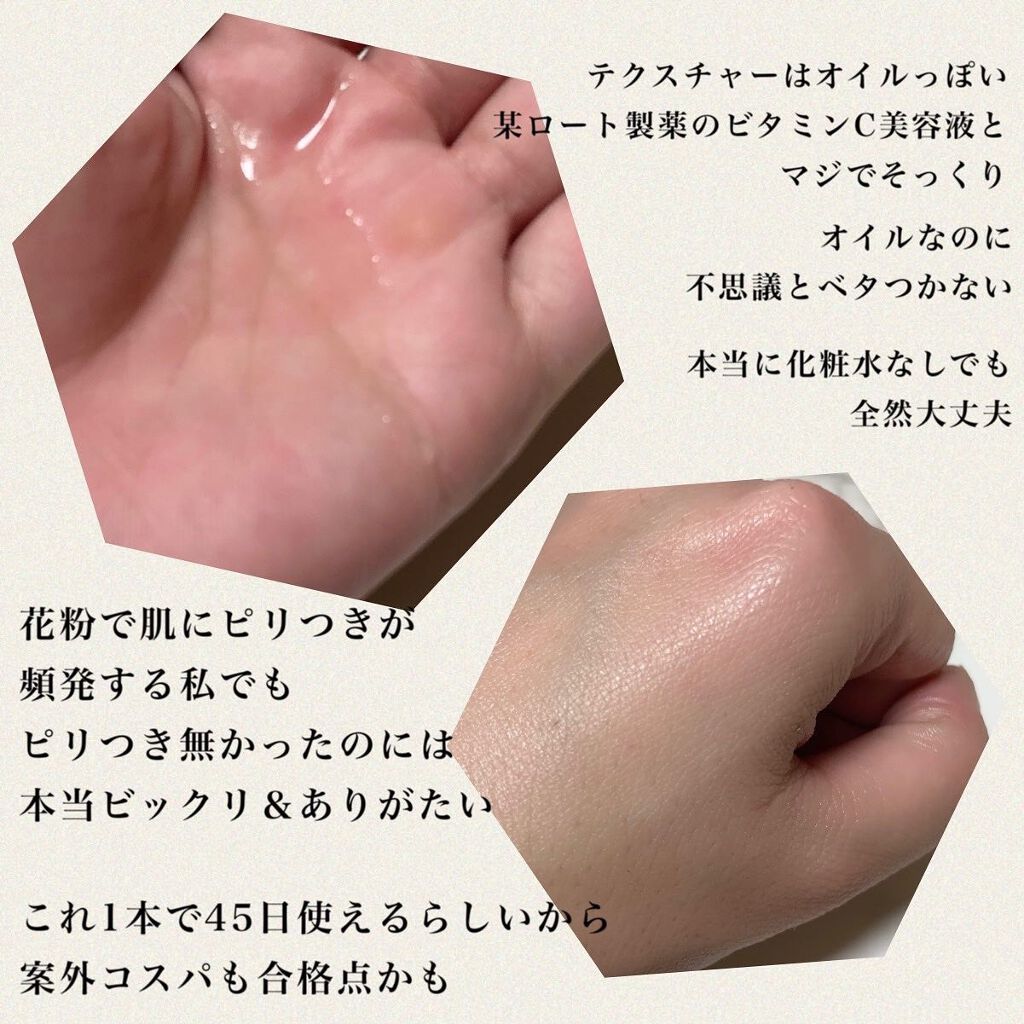 VC ホワイトピールセラム/SKIO/ブースター・導入液を使ったクチコミ（3枚目）