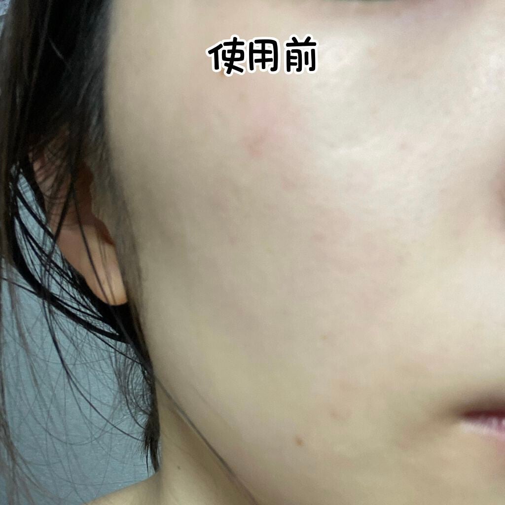 ザビタミンC23/IOPE/美容液を使ったクチコミ(3枚目)