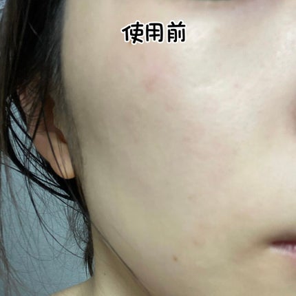 ザビタミンC23/IOPE/美容液を使ったクチコミ(3枚目)