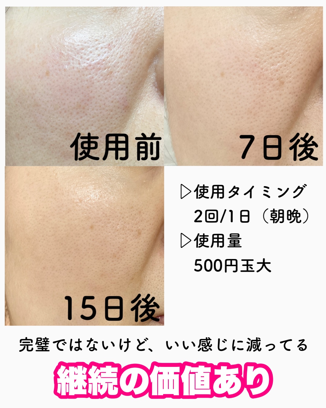 ホーリーバジルスキンコントローラー/FLOUN/化粧水を使ったクチコミ（2枚目）