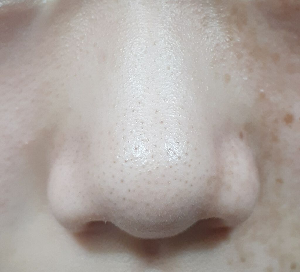 ホワイト もこもこ白泡マスク/リッツ/洗い流すパック・マスクを使ったクチコミ（2枚目）