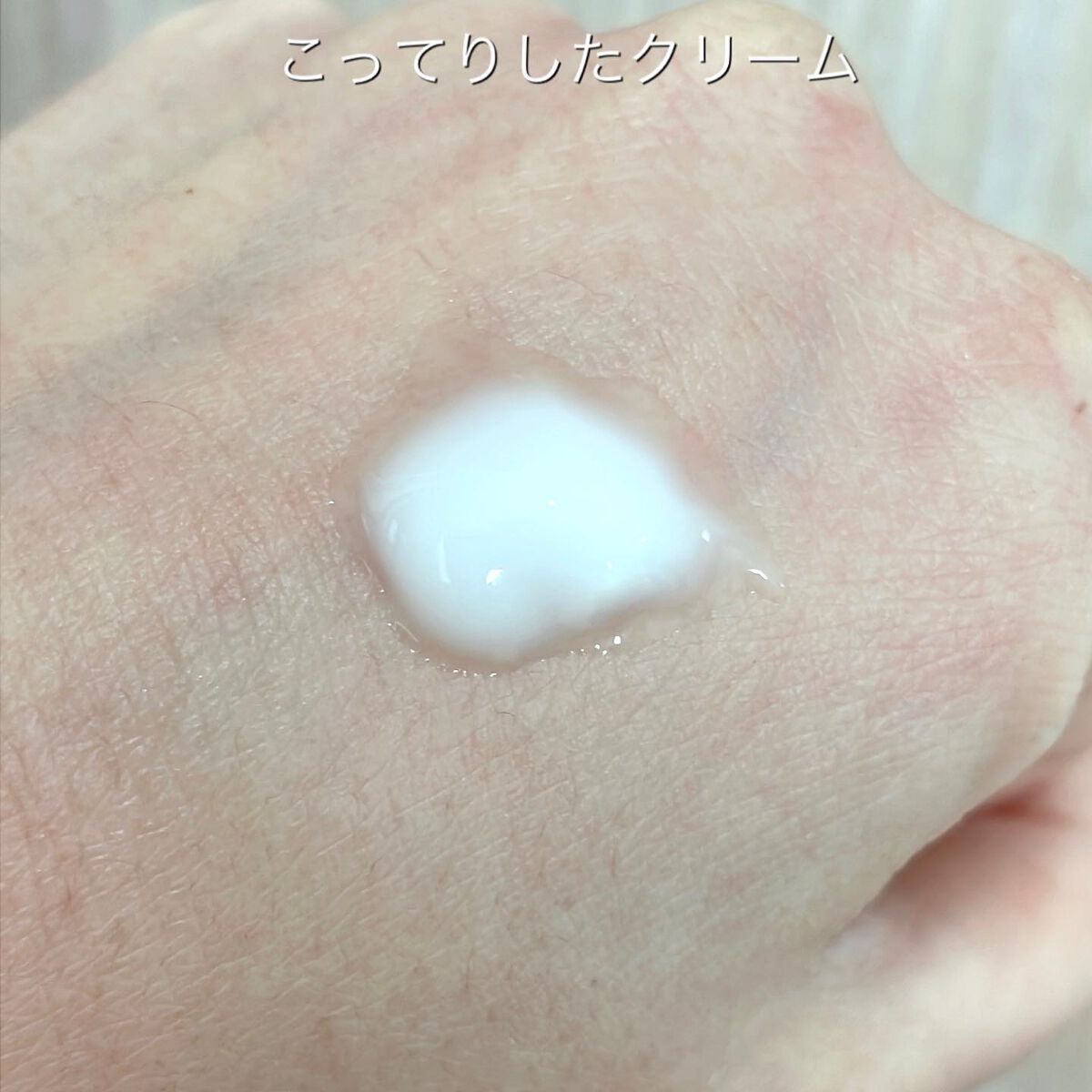 レッドブレミッシュスージングボディーミスト/Dr.G/ボディローションを使ったクチコミ(6枚目)