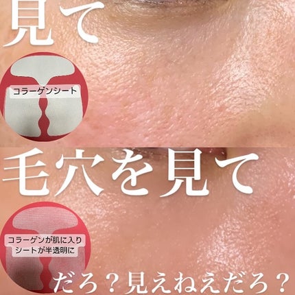 ドクタージー ブラックスネイル コラーゲンミスト/Dr.G/ミスト状化粧水を使ったクチコミ(4枚目)