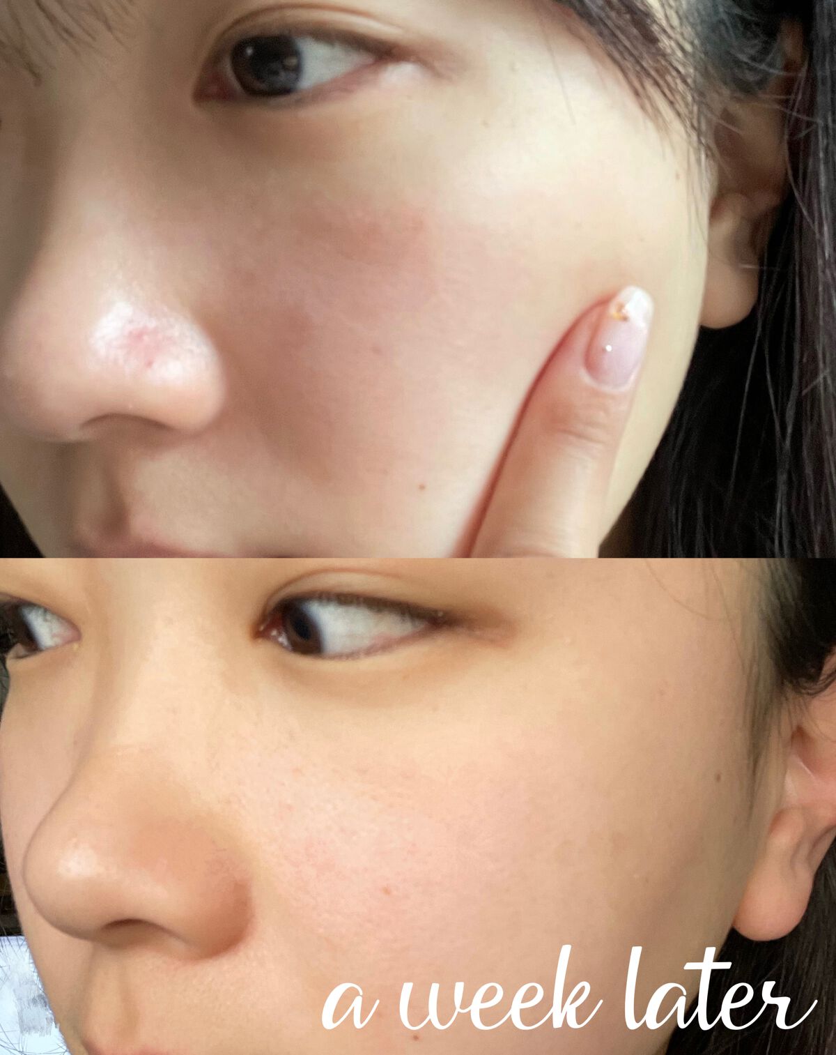 バイオ コンディショニング エッセンス/IOPE/ブースター・導入液を使ったクチコミ（3枚目）