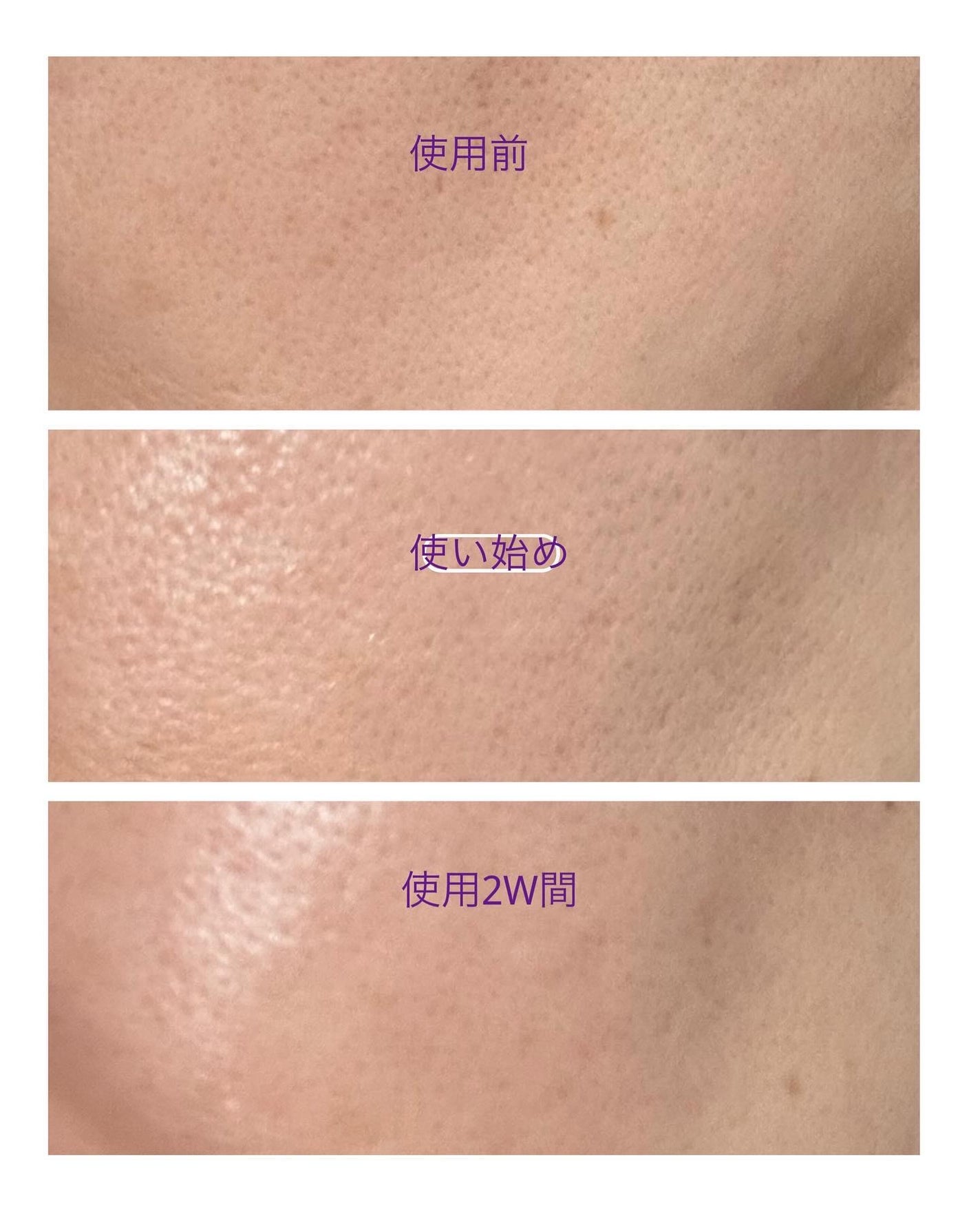 ペプチドレチナールセラム/ONE THING/美容液を使ったクチコミ(9枚目)