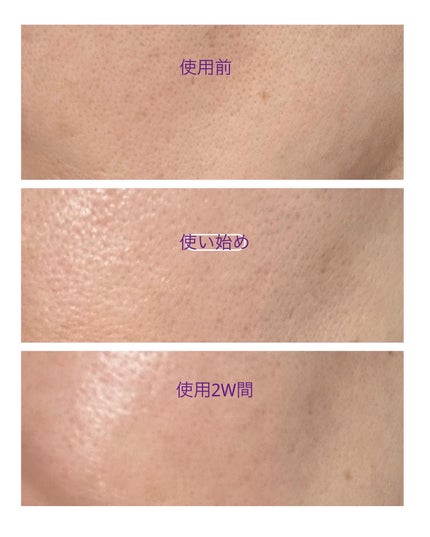 ペプチドレチナールセラム/ONE THING/美容液を使ったクチコミ(9枚目)