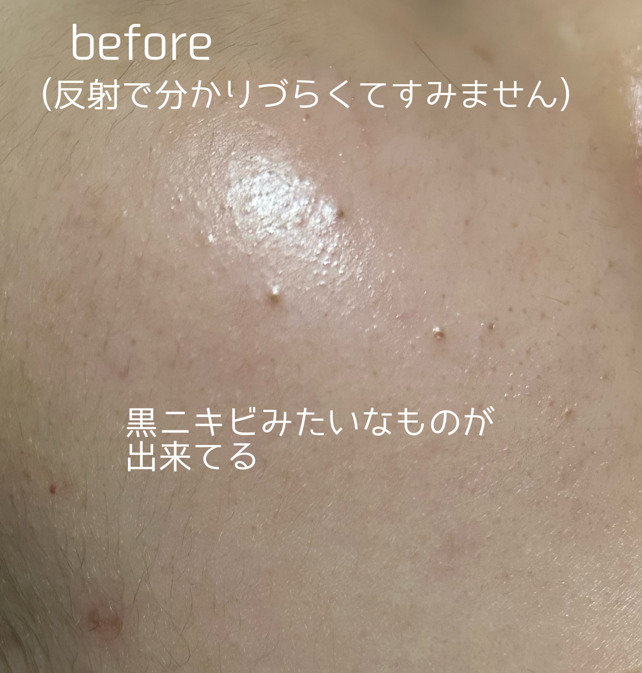 レチノールインテンスデイリーマスク/SOME BY MI/シートマスク・パックを使ったクチコミ（2枚目）