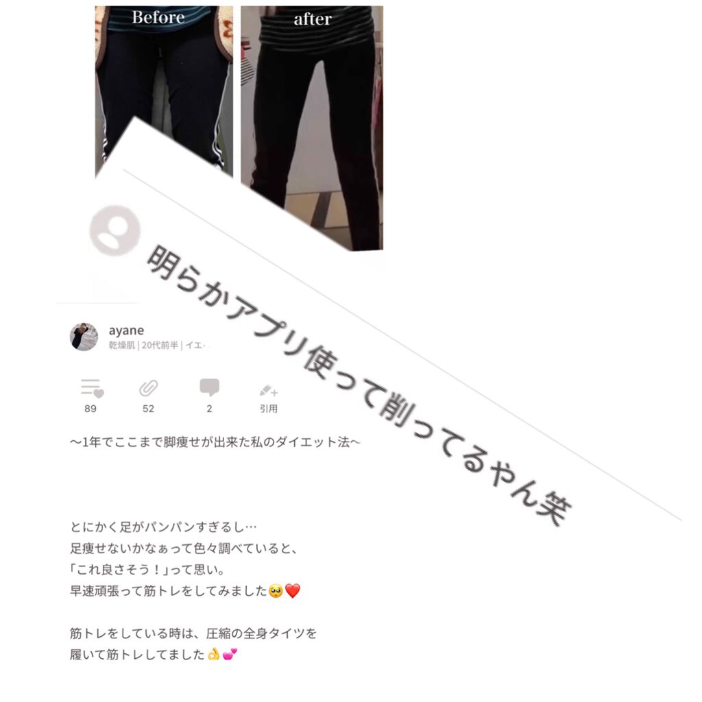 寝ながらメディキュット フルレッグ/メディキュット/着圧ソックス・レギンスを使ったクチコミ（1枚目）