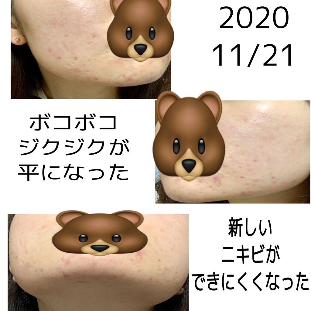 モイストリファイン 乳液 II しっとり/ファンケル/乳液を使ったクチコミ（3枚目）