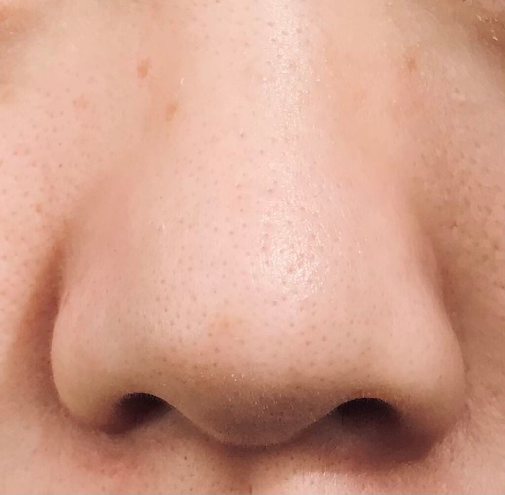 ノーモアブラックヘッド(ノーズピーリング)/One-day's you/スクラブ・ゴマージュを使ったクチコミ(4枚目)