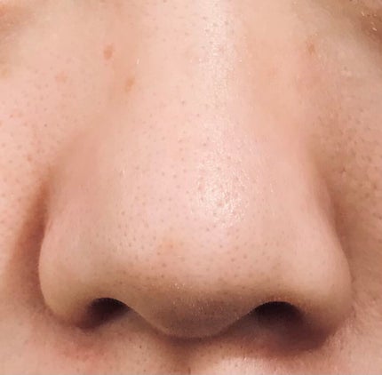 ノーモアブラックヘッド(ノーズピーリング)/One-day's you/スクラブ・ゴマージュを使ったクチコミ(4枚目)