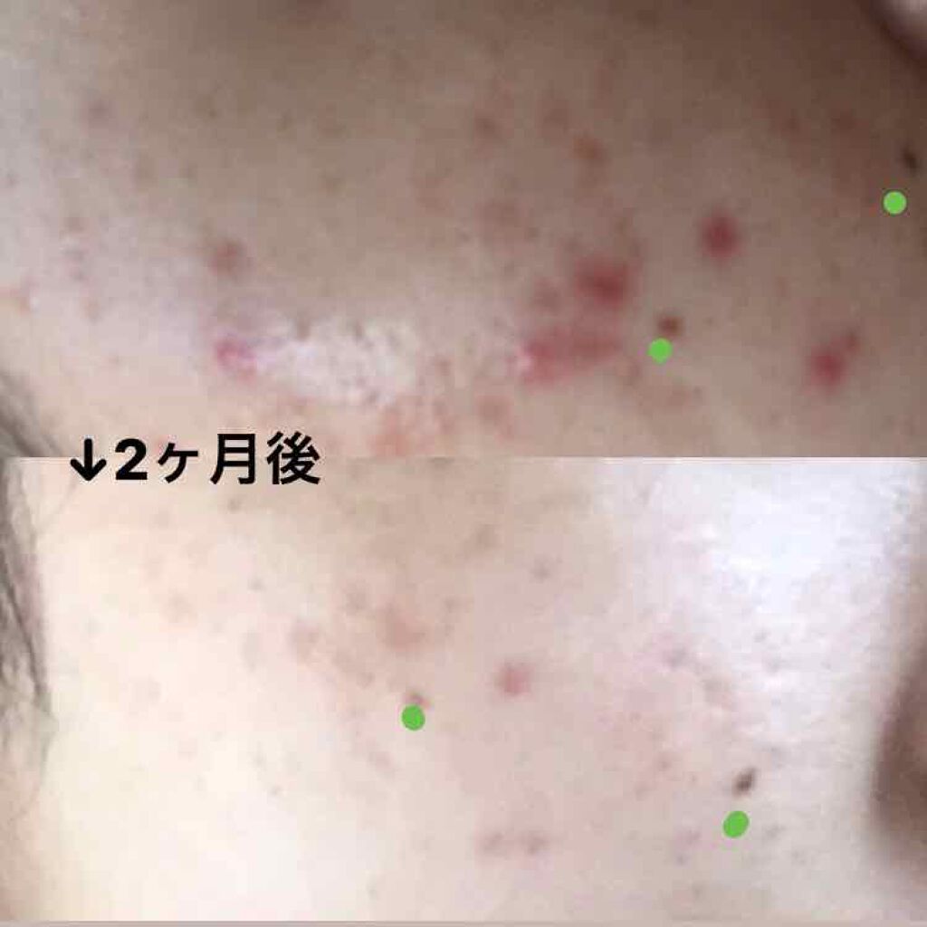 彩花 on LIPS 「1枚目はSODAで撮ったので加工ありです🤒2枚目は無加工のカメ..」(2枚目)