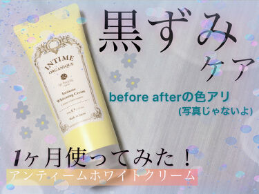 アンティーム ホワイトクリーム アンティーム オーガニックの使い方を徹底解説 バストトップの黒ずみケアを1ヶ月やってみま By ねぎ 代前半 Lips