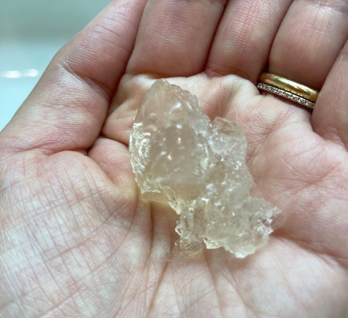 シカキュア クラッシュジェリーウォッシュ/山忠/その他洗顔料を使ったクチコミ（2枚目）