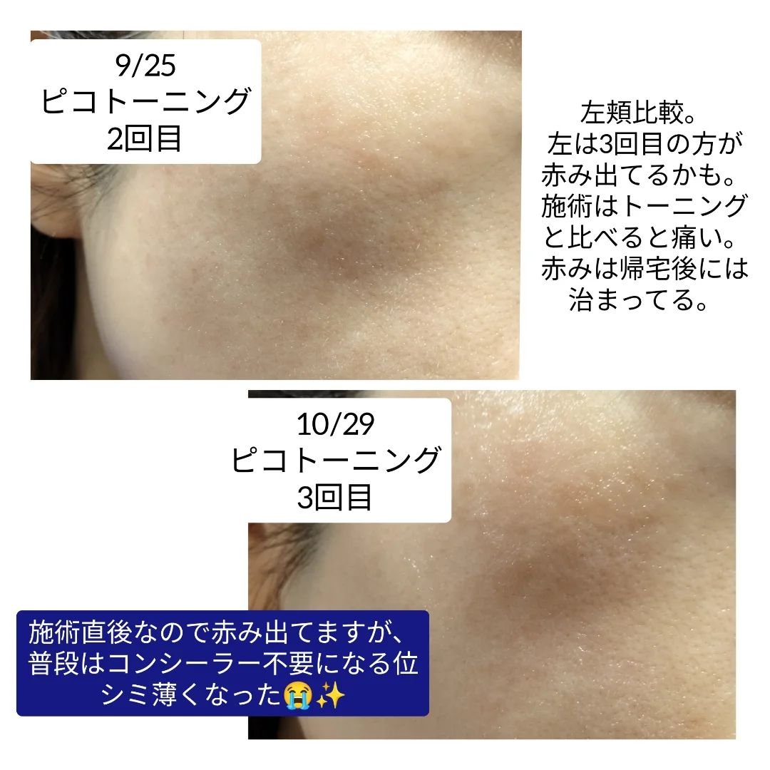 を使ったクチコミ（3枚目）