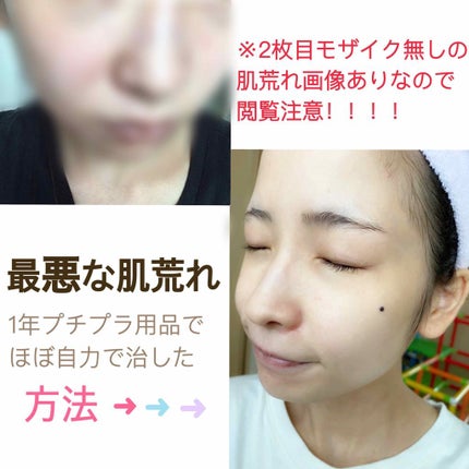 を使ったクチコミ(1枚目)