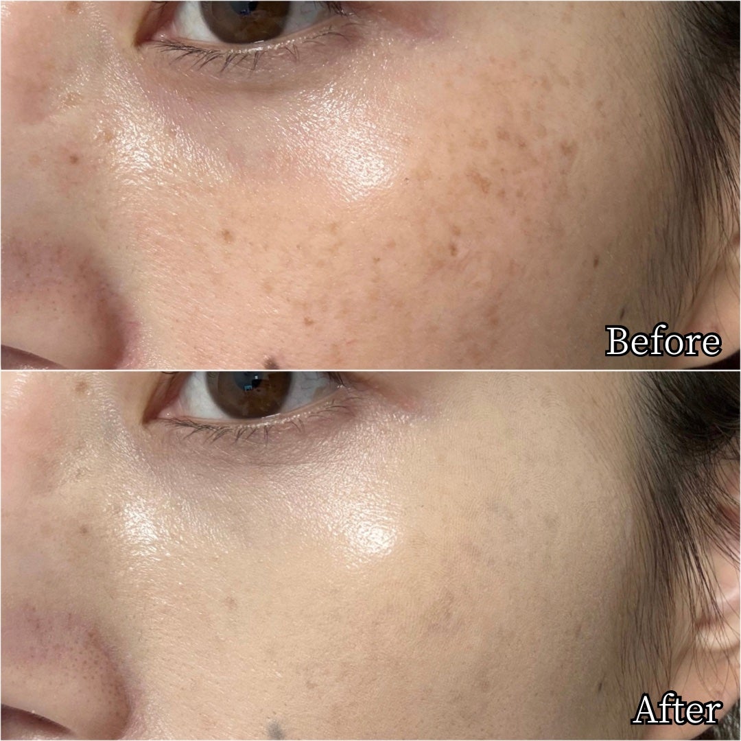 ダーマシンコンシーラー/23years old/リキッドコンシーラーを使ったクチコミ(8枚目)