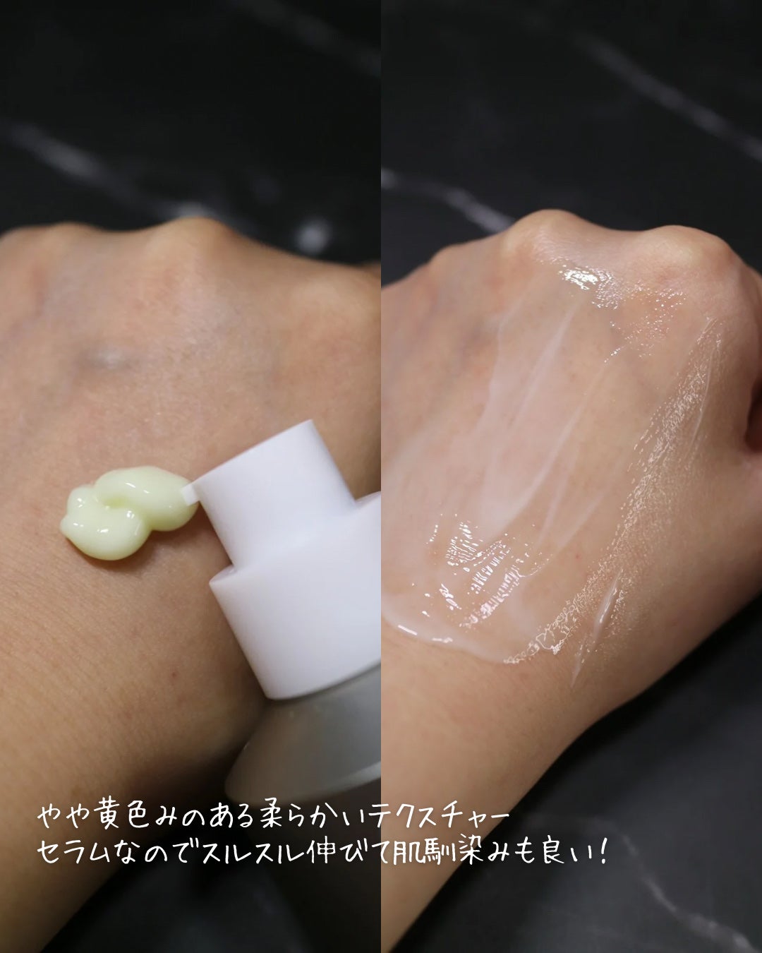 ヴィーガンリポソームレチノールセラム/SKIN&LAB/美容液を使ったクチコミ(7枚目)