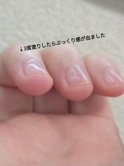 ジェルボリュームトップコート/キャンメイク/ネイルトップコートを使ったクチコミ(5枚目)