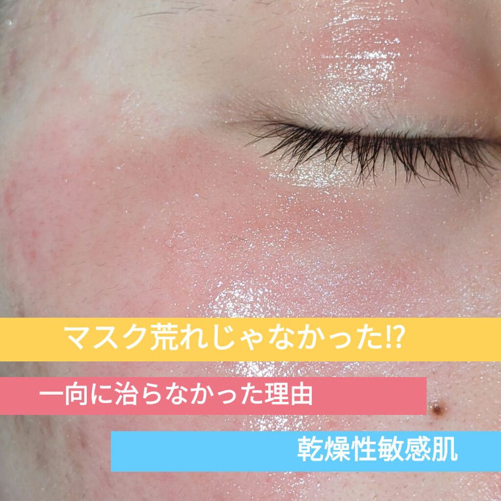 あい on LIPS 「 3日前から始めたマスク荒れ改善でしたが、「あれ?」と昨日、目..」(1枚目)