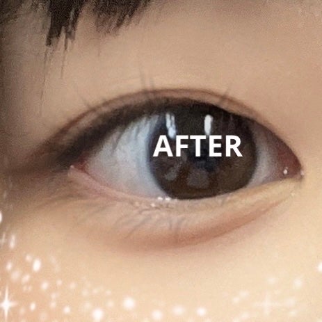 りそうのふたえ 埋没式くっきり形成/DAISO/二重まぶた用アイテムを使ったクチコミ(4枚目)